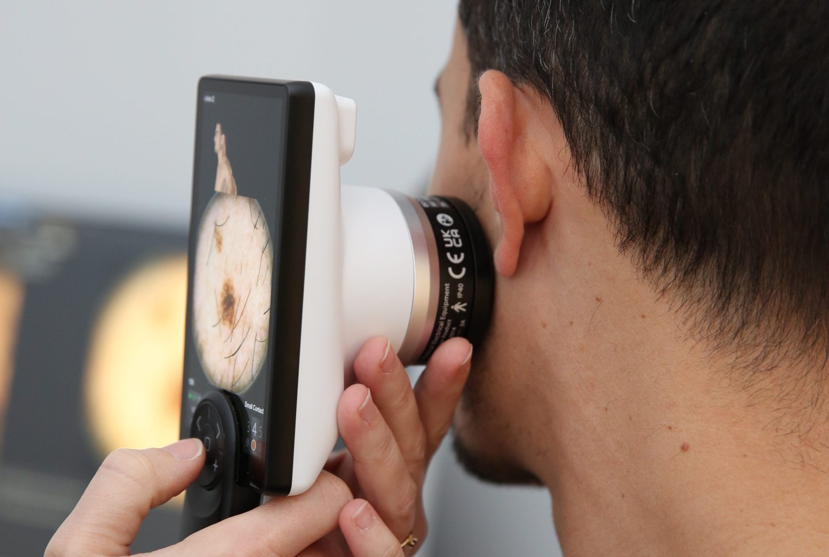 SkinView Medic opens AI-powered skin cancer center in Le Bouscat